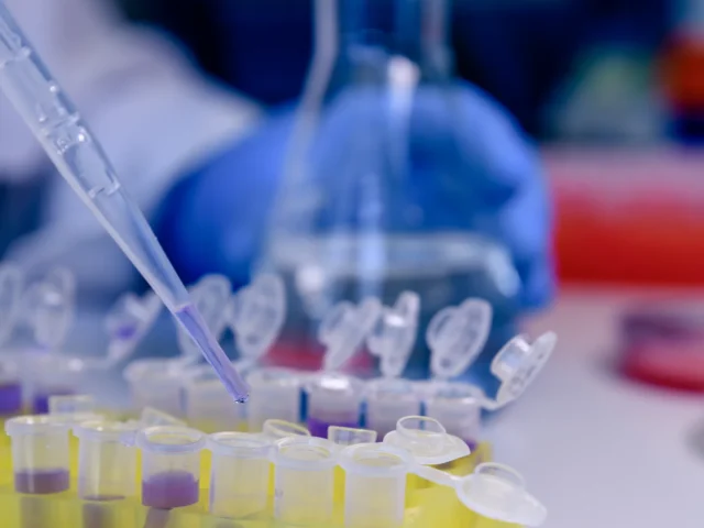 Pipeta transferindo amostra para tubos em bancada de laboratório