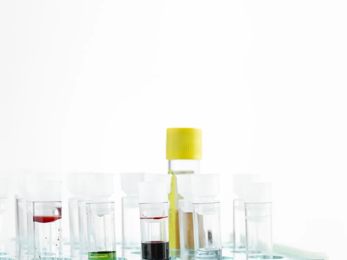 Tubos de ensaio com amostras em uma estante de laboratório