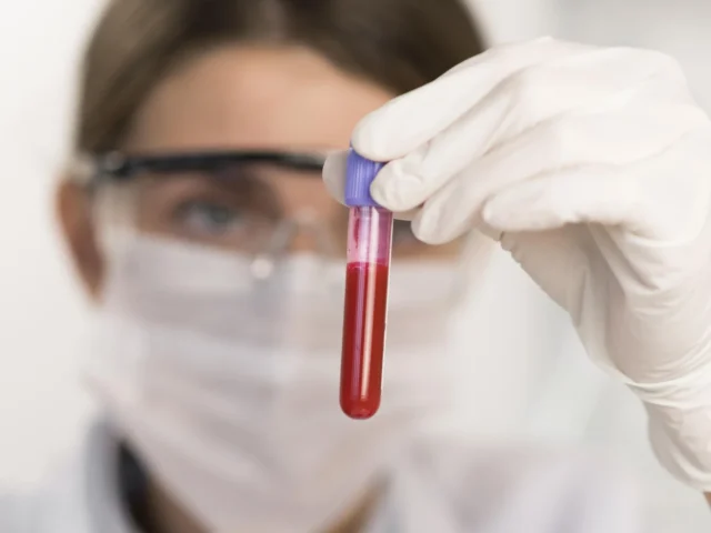 Profissional de laboratório observando uma amostra em tubo